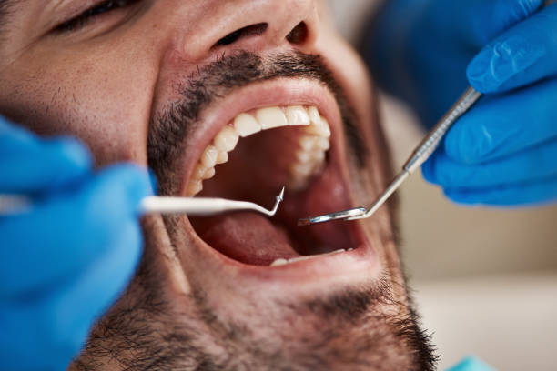 Dental X-Rays and Imaging in Crested Butte, CO